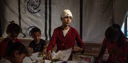 La niña Hala Abu Dahlez, herida por un bombardeo.
