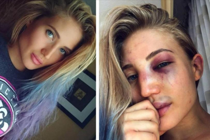 Anastasia Yankova, en sendas imágenes colgadas en su cuenta de Instagram, antes y después de la pelea.