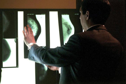 Una persona examina varias mamografias durante un curso internacional de la Sociedad Española de Diagnostico por Imagen de la Mama