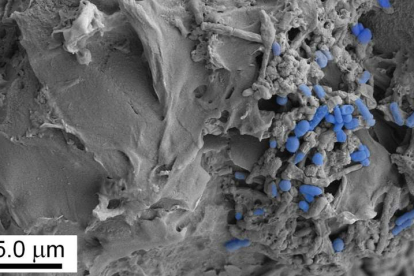 Imagen microscópica de microplásticos colonizados por la microbiota intestinal. CSIC