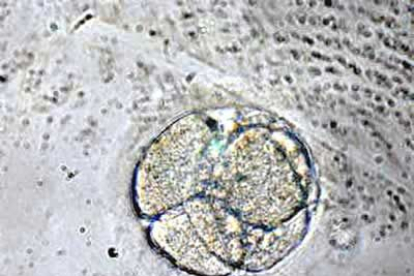 Ese tipo de técnica biomédica en la cual se utilizan células madre embrionarias ayudará a reemplazar células dañadas por enfermedades degenerativas e incurables como el mal de Parkinson y la diabetes.