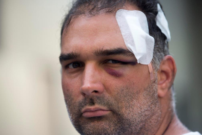 José Bravo, el turista estadounidense de origen cubano que fue agredido el miércoles por un grupo de manteros