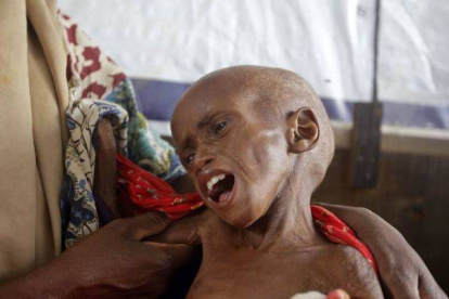 Las Naciones Unidas declararon la hambruna en dos regiones del sur de Somalia e imploraron ayuda humanitaria urgente por la grave crisis alimentaria que sufre el país. Foto: AGENCIAS
