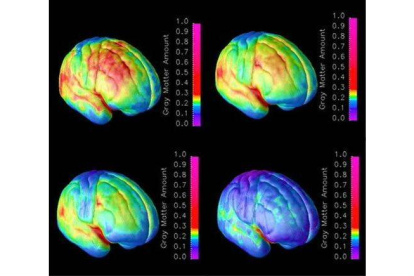 Combo de imágenes que muestran el proceso de maduración del cerebro.