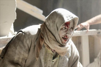 Una mujer herida por los ataques aéreos en Alepo.