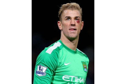 El portero del Manchester City Joe Hart, con un ojo morado producido por un choque con un jugador del Crystal Palace.