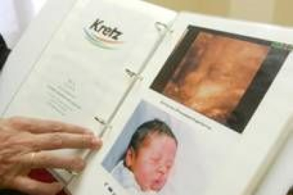 Imagen de un recién nacido y de su foto obtenida con ecográfo