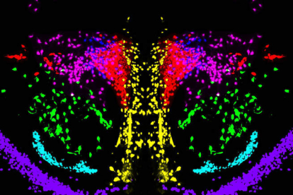Imagen de las conexiones cerebrales coloreadas que han dado la pista a los científicos. CSIC