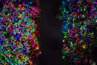 Células de cáncer de páncreas PANC-1 durante un proceso de migración celular. ITEFI-CSIC