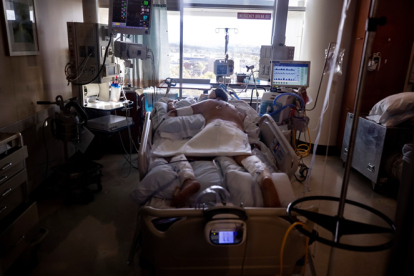 Un enfermo de covid ingresado en una unidad de cuidados intensivos descansa sobre su estómago para respirar con más facilidad. EFE
