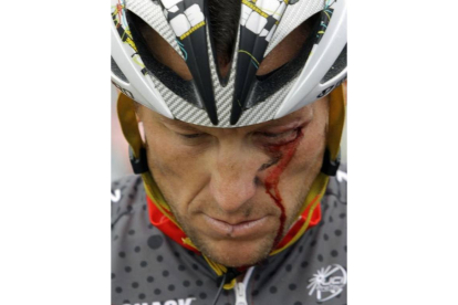 Armstrong sangra a causa de una aparatosa caída sufrida durante la Vuelta a California en 2011. Foto: AP