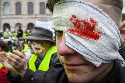 Los chalecos amarillos, con heridas falsas en los ojos, durante una manifestación.