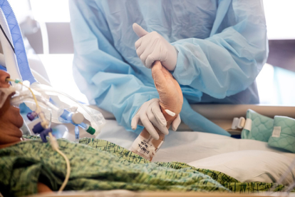 Una enfermera trata a un paciente con covid-19, moviendo sus dedos y muñecas, en una Unidad de Cuidados Intensivos. EFE