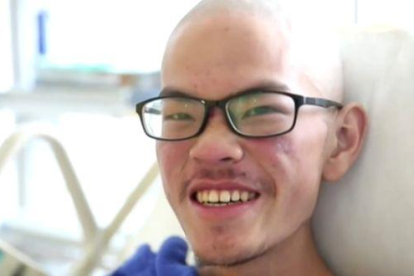 El montañero taiwanés Liang Sheng-yu en el hospital durante se recupera de sus heridas.