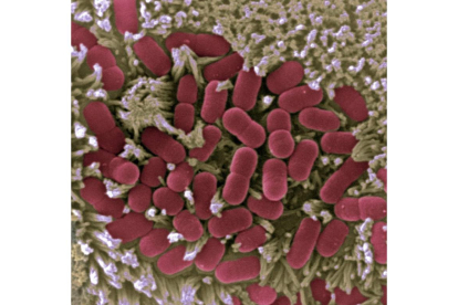 Imagen microscópica de la mucosa intestinal afectada por E.coli. CNB-CSIC