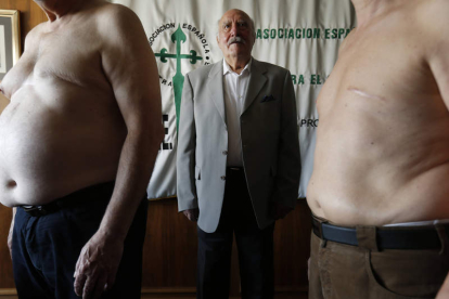 Tres hombres que han sobrevivido al cáncer de mama muestras sus cicatrices y cuentan su lucha en la Asociación Española Contra el Cáncer.