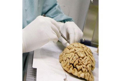 El cerebro, gran desconocido. F. A.