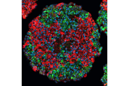 Imagen de un islote pancreático derivado de células madre. DL