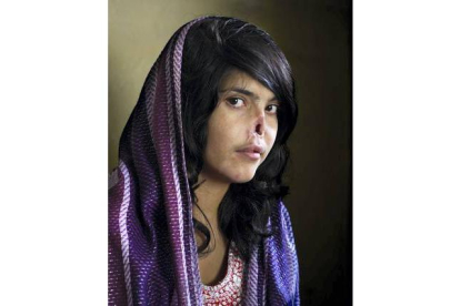 La fotografía ganadora de esta edición, de la sudafricana Jodi Bieber, inmortaliza a Bibi Aisha, una chica afgana de 18 años que fue mutilada como castigo por huir de la casa de su marido en la provincia de Oruzgan, en el centro de Afganistan.
