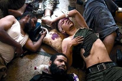 Seguidores de Mursi yacen heridos en el suelo de un hospital improvisado.