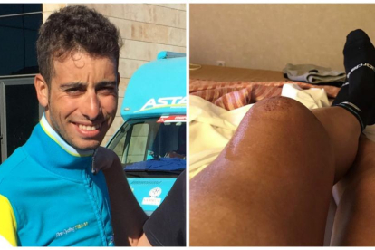 El ciclista italiano Fabio Aru y su maltrecha rodilla.