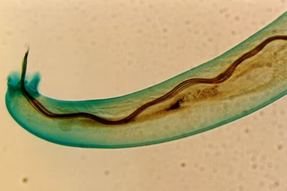 Angiostrongylus cantonensis, gusano pulmonar de las ratas. Wikimedia Commons / Punlop Anusonpornperm, CC BY-SA