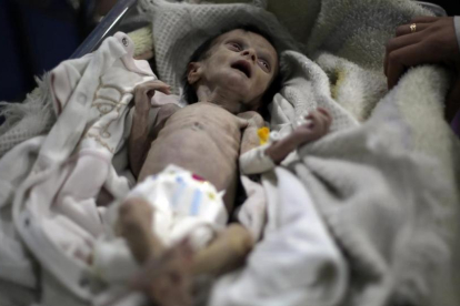 El pequeño Sahar Dofdaa poco antes de morir por desnutrición.