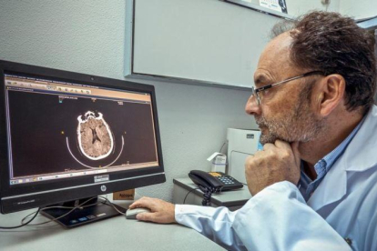 Jaume Roquer, jefe de Neurología del Hospital del Mar, analiza un TAC cerebral.