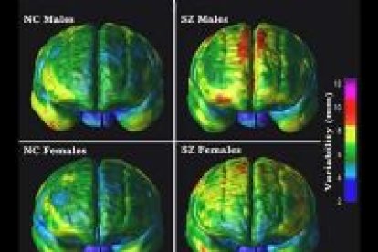 El primer mapa del cerebro completo estará terminado para el 2005