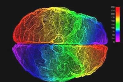 A partir de escáners como el de la fotografía se lleva a cabo un proyecto que podrá prevenir enfermedades como el alzhéimer o el parkinson.