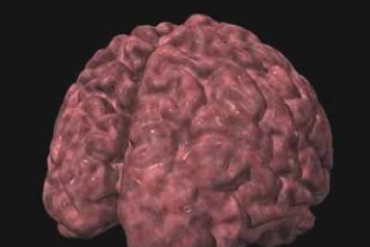 Esta es la apariencia de un cerebro normal, más uniforme y menos abultado que el cerebro afectado por alzhéimer.