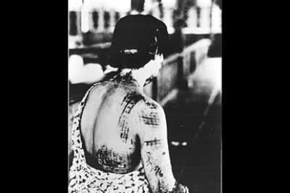 La piel de una víctima, con quemaduras en forma de crucigrama. Los dibujos negros del quimono absorbieron y radiaron el intenso calor de la explosión, dejando quemaduras con su forma en su espalda.