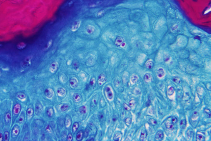 Imagen ampliada de una muestra de piel de un mono infectado con el virus. EFE