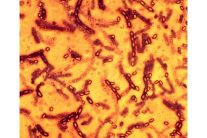 Esporas de la bacteria Bacilus antracis, que causa el ántrax, en una imagen de archivo.