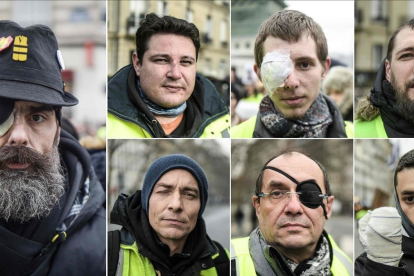 Algunos de los manifestantes chalecos amarillos que acusan a la policía francesa de sus heridas.