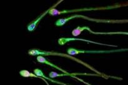 La esterilidad de una de cada cuatro parejas se debe a alteraciones en los espermatozoides