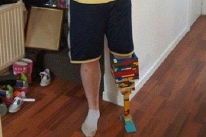 La pierna de Matt Cronin hecha con Lego.