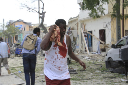 Un herido en el ataque al hotel Dayah de Mogadiscio.