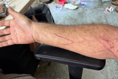 Brazo de Frank Cuesta tras el ataque.