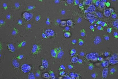 Macrófagos de ratón tratados in vitro con el compuesto MACTIDE-V que han sido expuestos a células de cáncer de mama (en verde). Fotografía facilitada por el CSIC / Pablo Scodeller. EFE