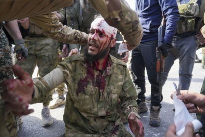 Un herido en los choques en Siria.