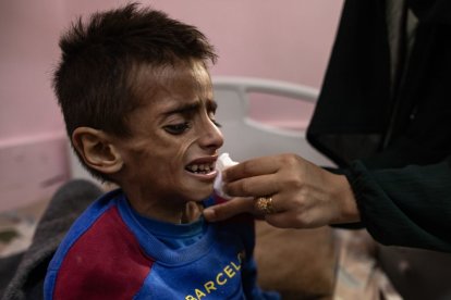 Osama al-Raqab, de 5 años, uno de los niños palestinos que sufre desnutrición severa.