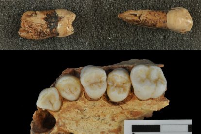 Estudio dental realizado en Atapuerca.
