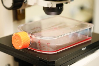 Biolfar utiliza los medios más adecuados para investigar el secretoma.
