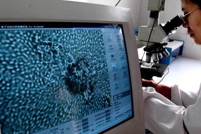 Imagen aumentada por un microscopio del líquido seminal en un estudio anterior.