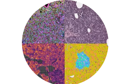 Nuevo atlas celular del páncreas humano.