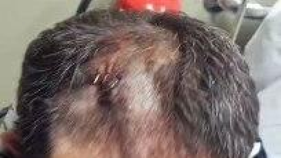 La víctima de Ciñera muestra los golpes tras ser atado y agredido