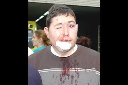Unas 900 personas resultaron heridas, algunas de ellas en estado crítico.