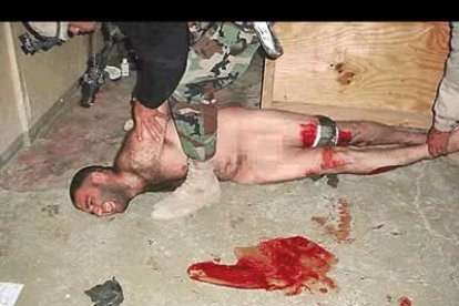 No sólo utilizaban a los perros para asustar a los prisioneros. Esta foto muestra a uno de los presos con heridas de mordiscos en ambas piernas.