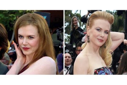 Nicole Kidman.